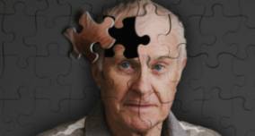Exercício físico previne o Alzheimer