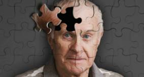 Alzheimer: teste detecta 20 anos antes