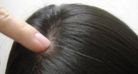 Estresse pode deixar cabelos brancos